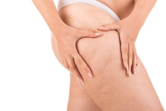 Tips To Get Rid Of Post-Pregnancy Cellulite The Natural Way - Mumberry